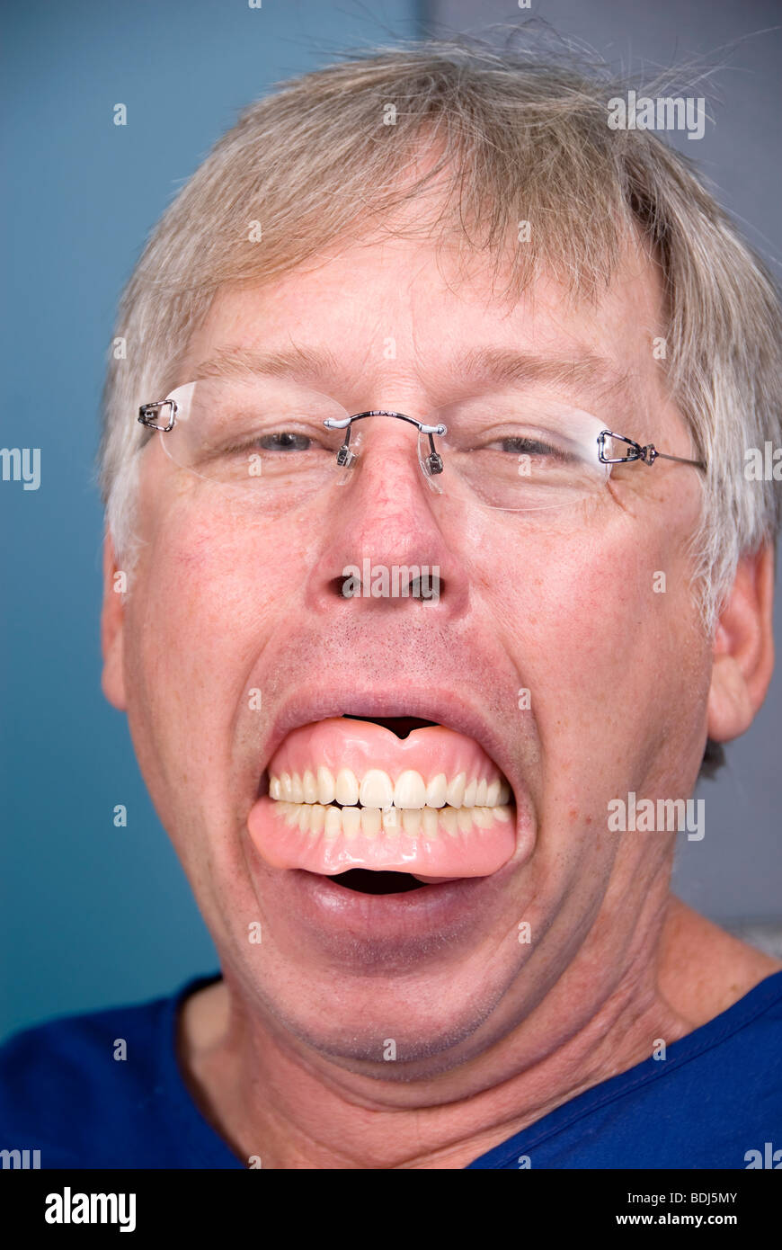 Un hombre muestra sus dientes postizos (prótesis) que muestra lo que ocurre cuando no se tiene una buena higiene dental. Foto de stock