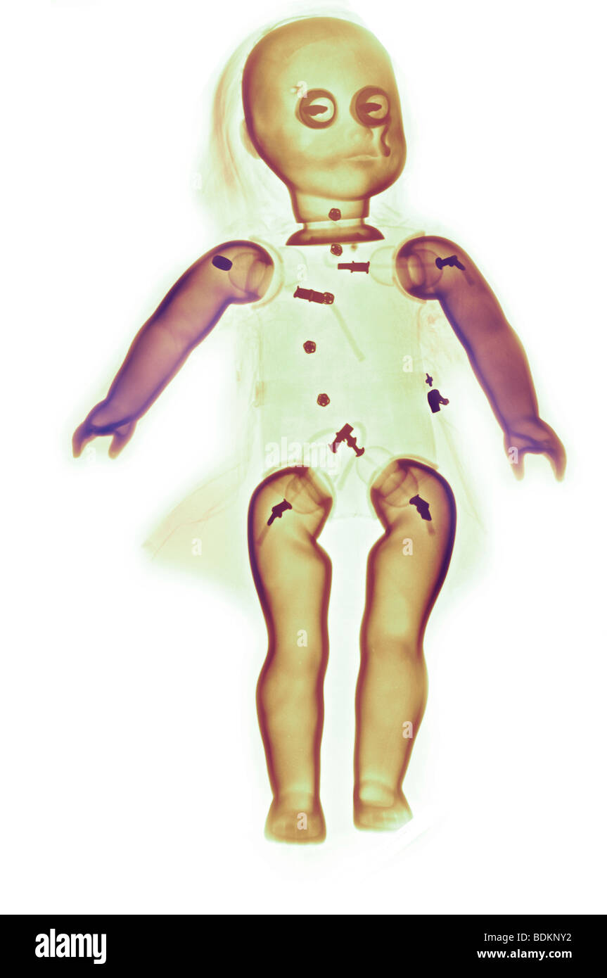Color de rayos x mejorada de una muñeca Foto de stock
