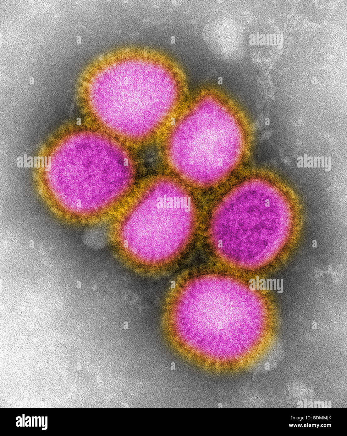 Imágenes de la reciente identificación de gripe H1N1 Foto de stock