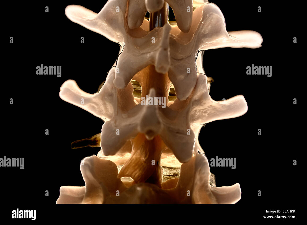 Primer plano de una columna vertebral humana mostrando las vértebras lumbares y discos vertebrales Foto de stock