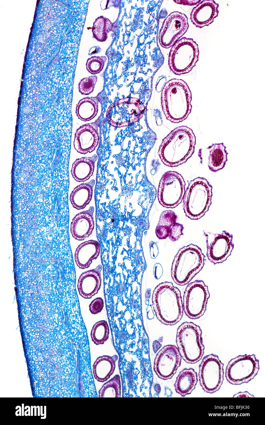 Brightfield microfotografía de semilla de adormidera cabeza, LS. Papaver sp. Detalle de semillas Foto de stock