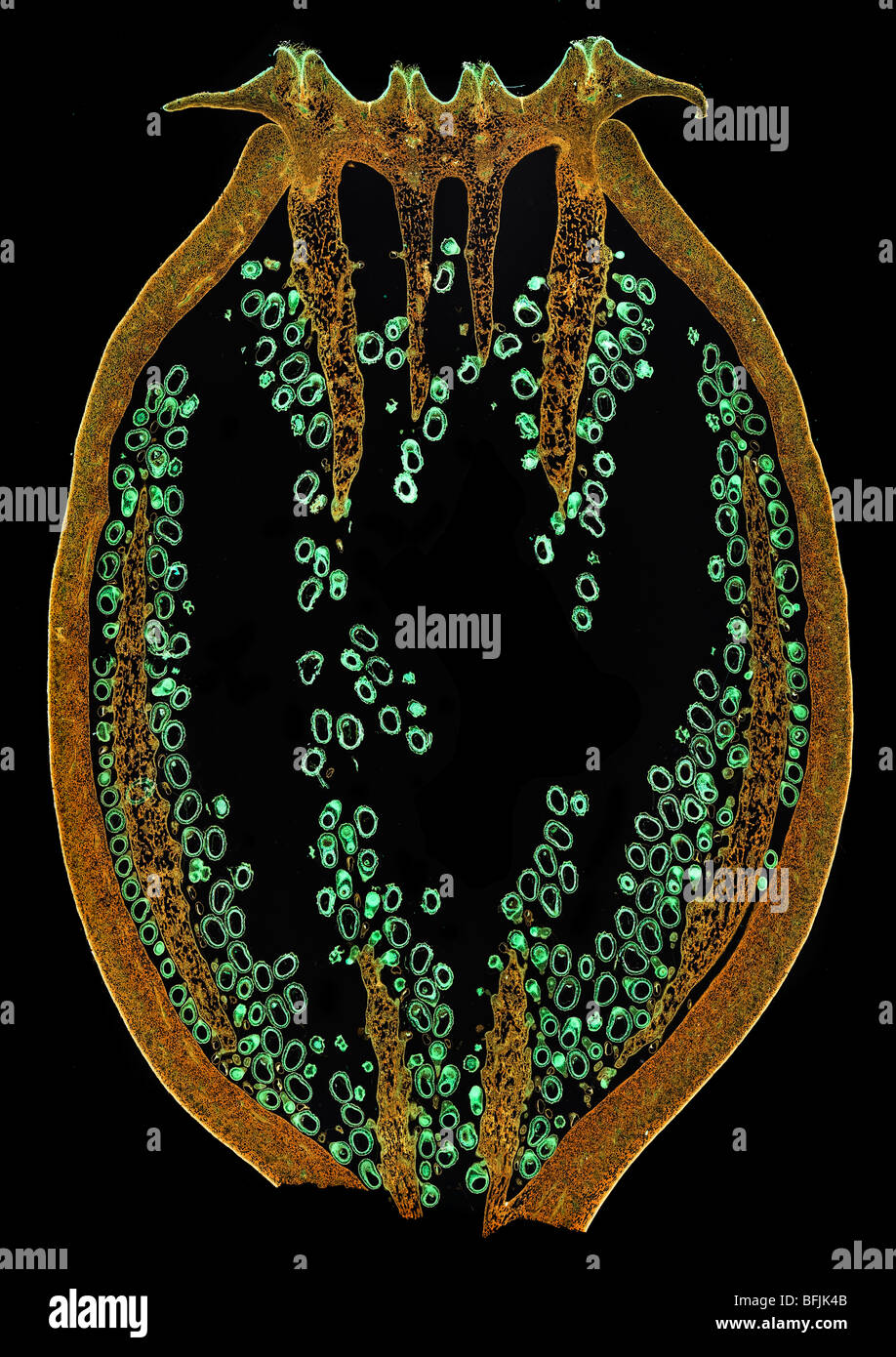Darkfield microfotografía de semilla de adormidera cabeza, LS. Papaver sp. Foto de stock
