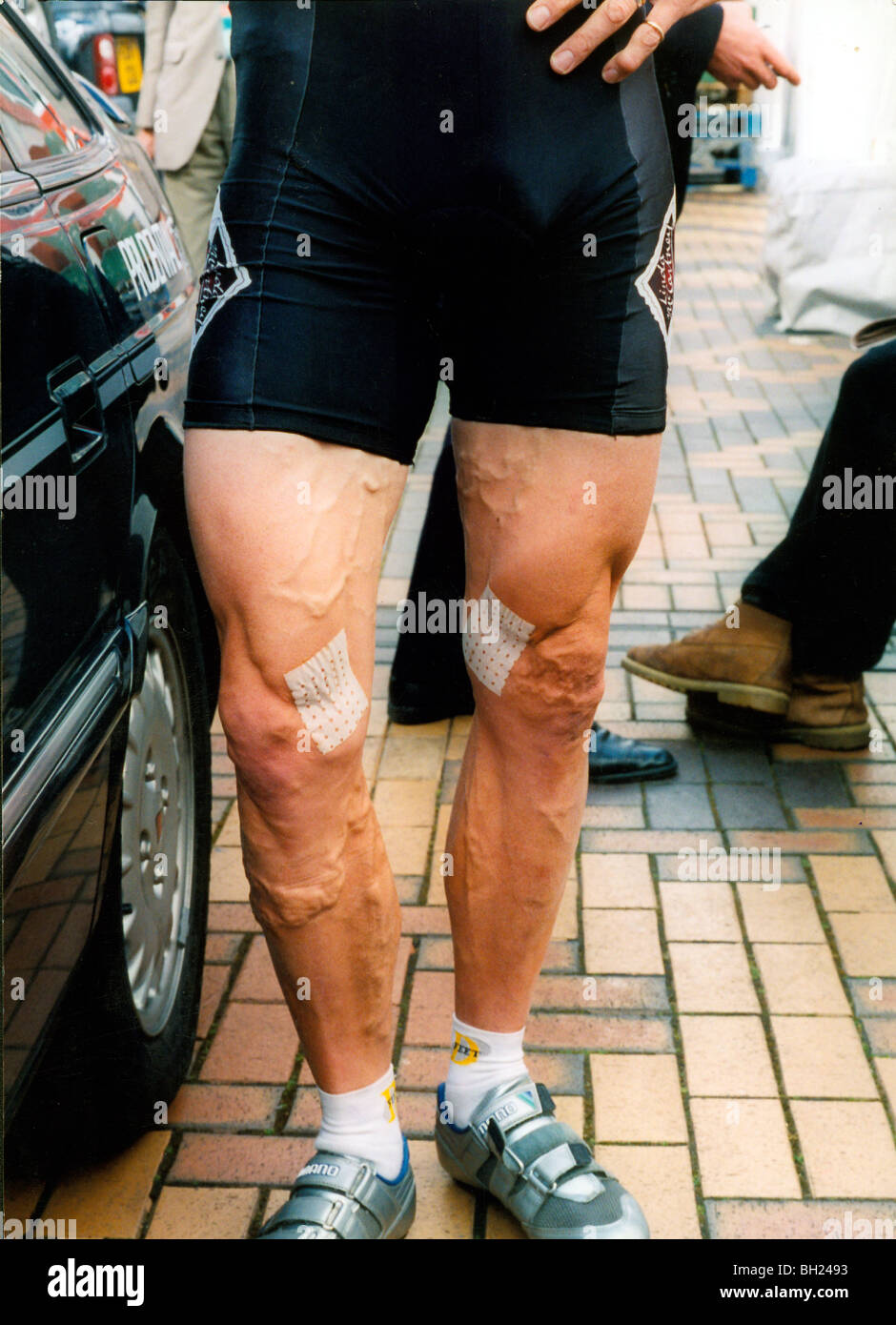 Ciclista muscular de piernas mostrando venas varicosas graves Fotografía de  stock - Alamy
