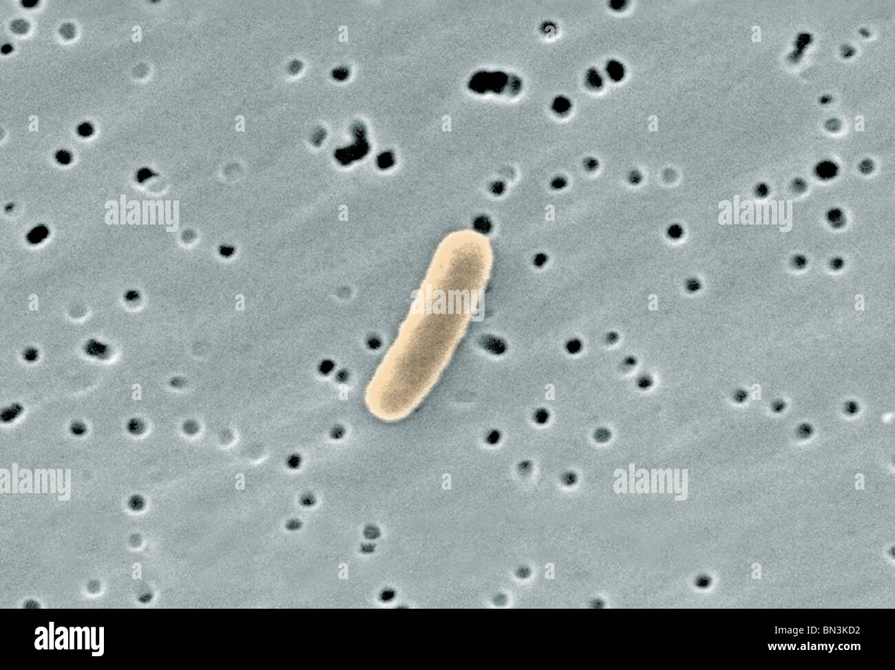 limpiar regional capa Gram-negativos, la bacteria Escherichia coli en una ampliación por microscopio electrónico de barrido Fotografía de stock - Alamy limpiar regional capa Gram-negativos, la bacteria Escherichia coli en una ampliación por microscopio electrónico de barrido Fotografía de stock - Alamy