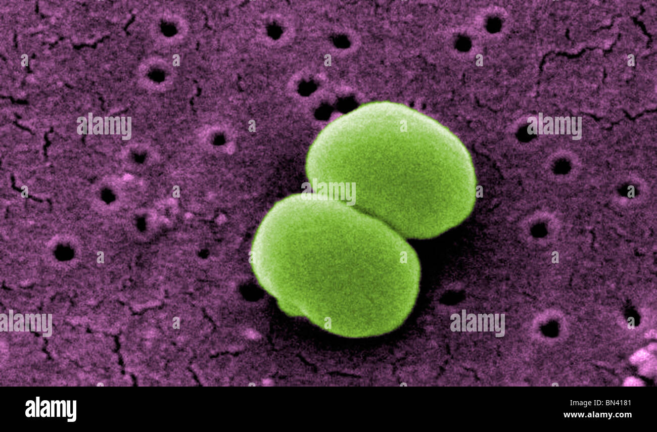 Análisis micrografía de electrones (SEM) de dos bacterias Gram-positivas Staphylococcus epidermidis Foto de stock