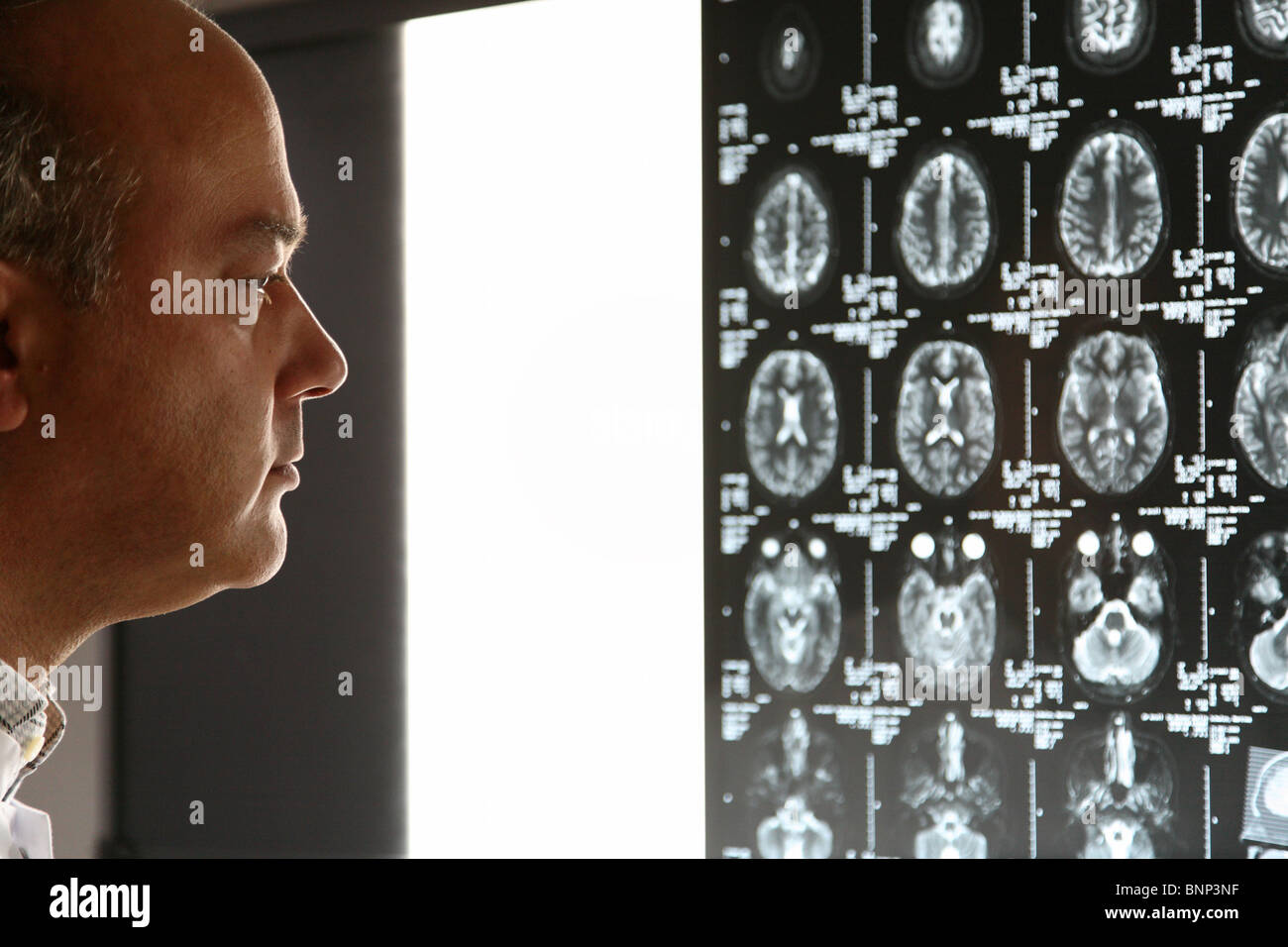 Thomas Muehlberger MD examina las imágenes de IRM de cabeza, Berlín, Alemania Foto de stock