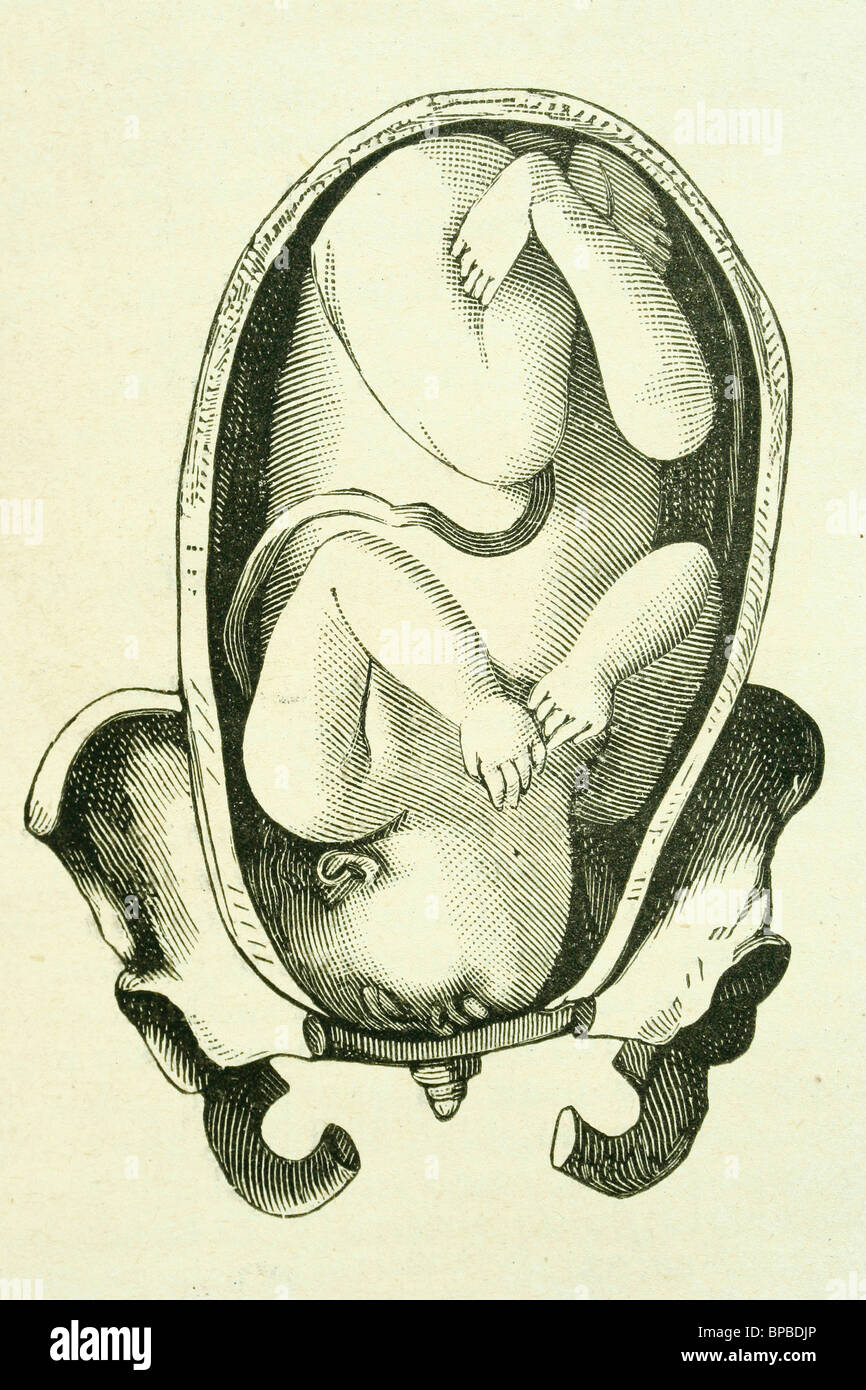 Posiciones anormales feto fotografías e imágenes de alta resolución Alamy