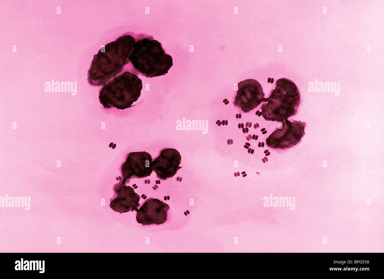 Esta microfotografía muestra una tinción de Gram del exudado uretral que es  diagnóstico de uretritis gonocócica Fotografía de stock - Alamy
