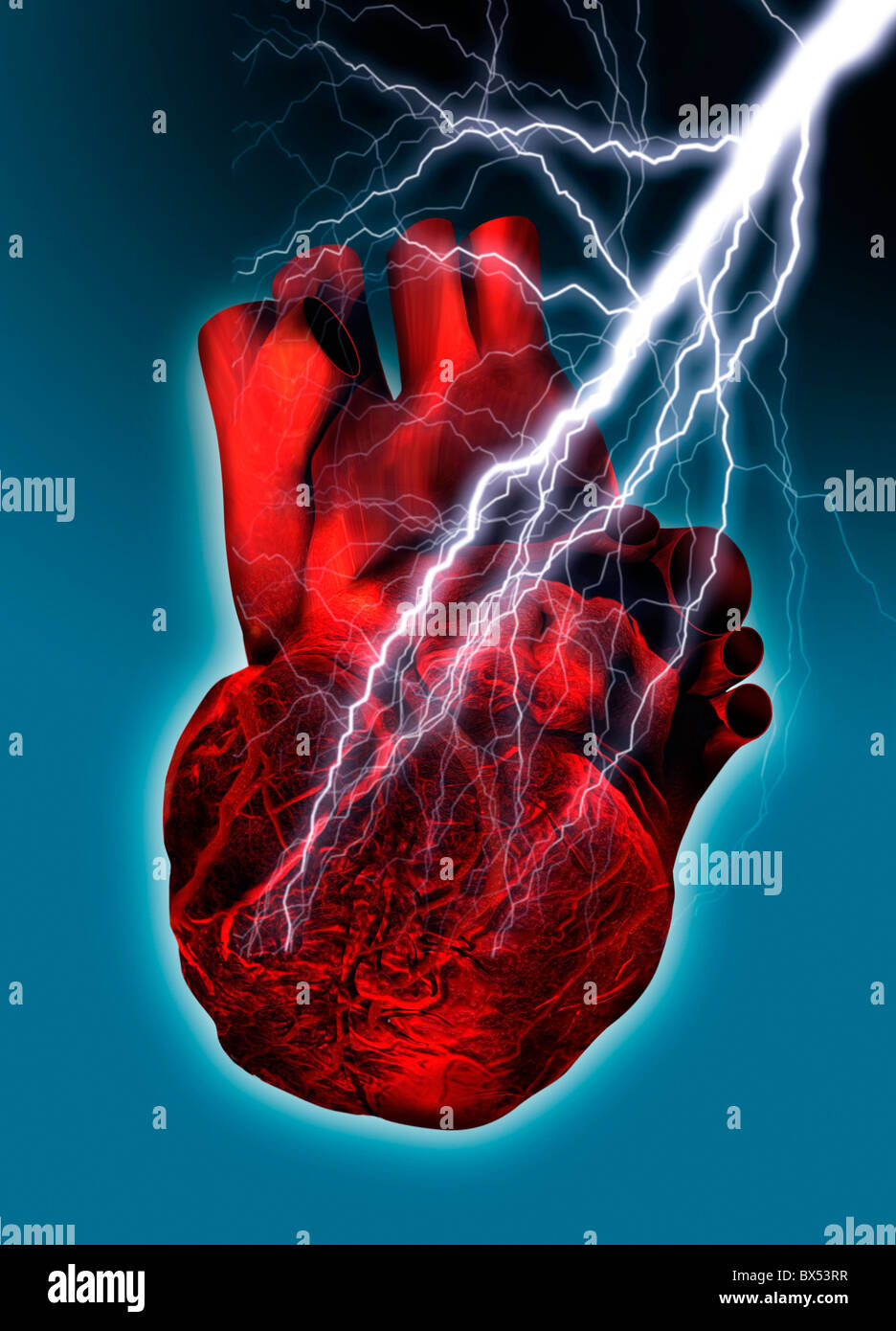 Ataque al corazón, obra conceptual Foto de stock