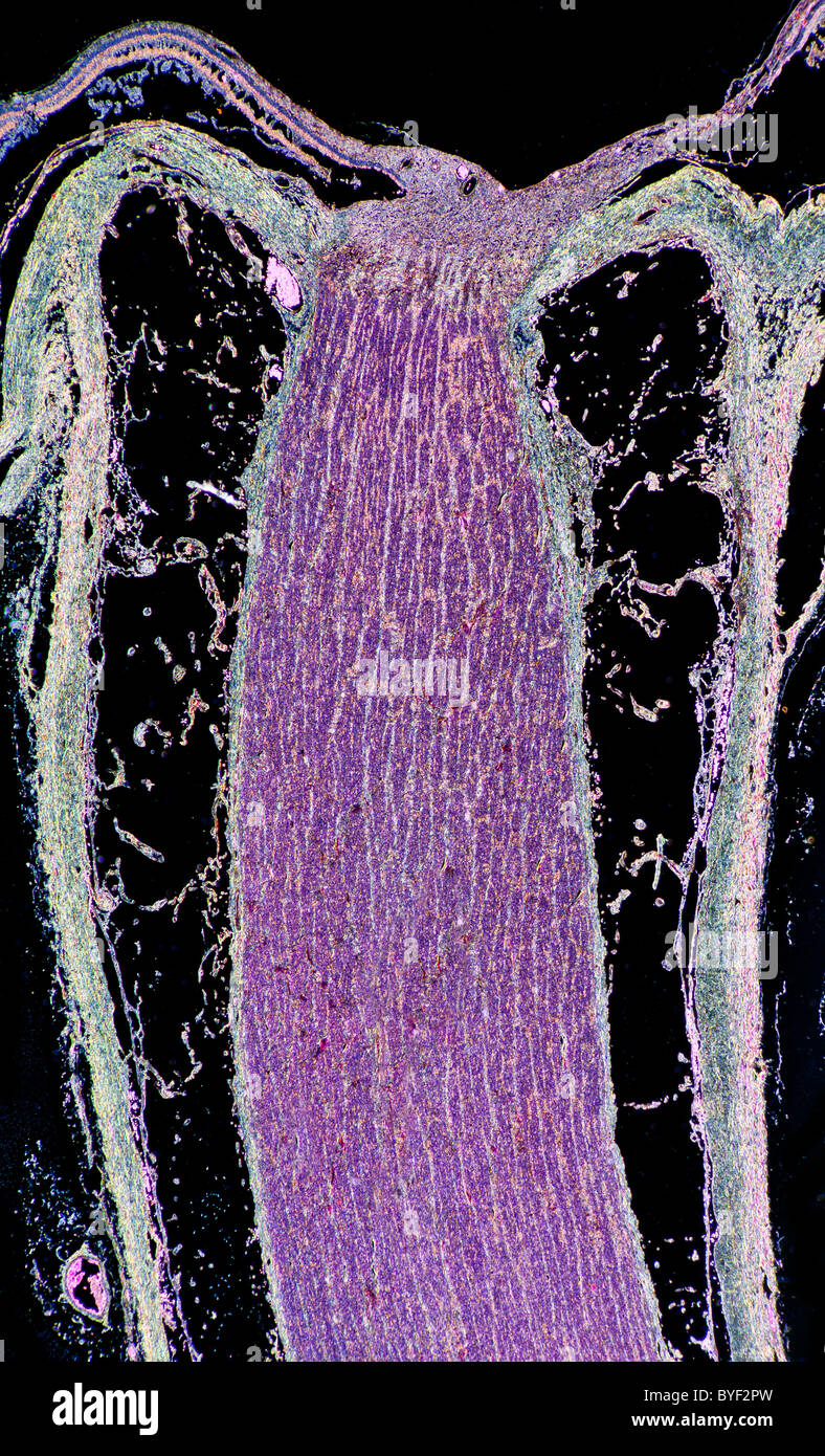 Darkfield microfotografía, detalle del nervio óptico del ojo humano Foto de stock