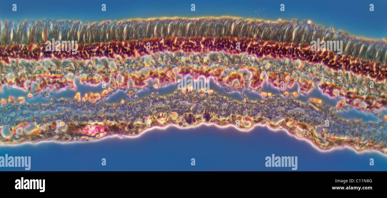 Darkfield microfotografía de una sección de la retina del ojo que muestra la estructura incluyendo las varillas y células cono Foto de stock