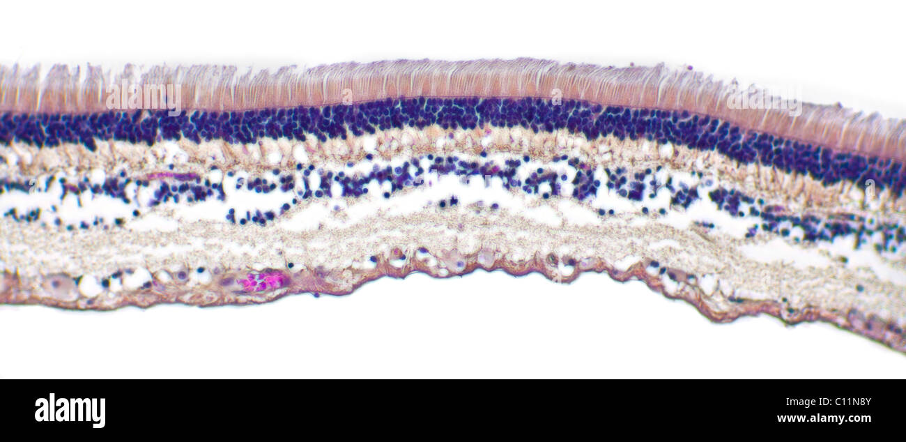 Brightfield microfotografía de una sección de la retina del ojo que muestra la estructura incluyendo las varillas y células cono Foto de stock