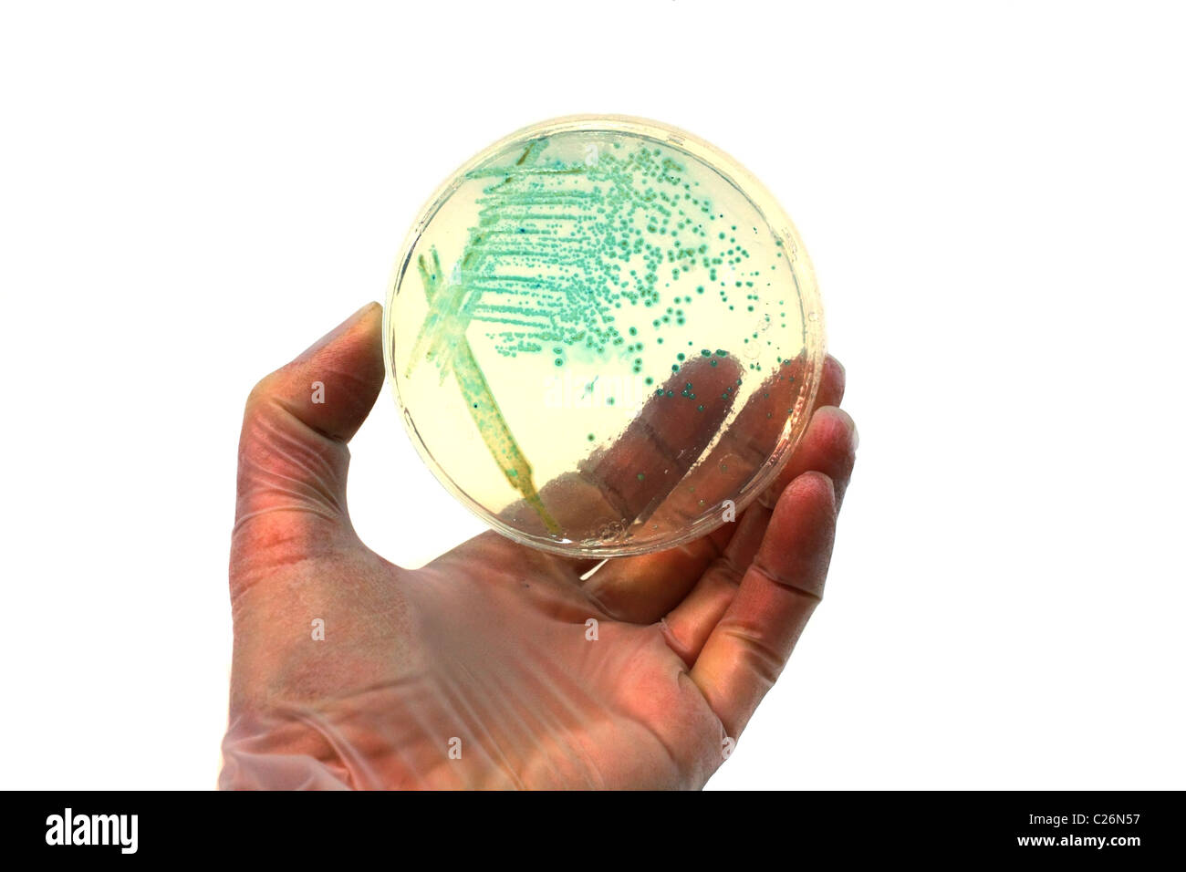 Mano a mano con la placa con las colonias de microorganismos Foto de stock