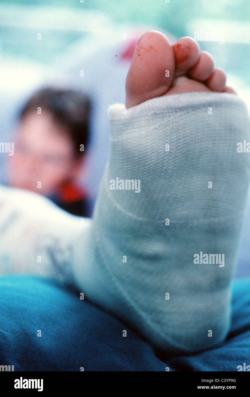 Pie vendado de adolescente Fotos e Imágenes de stock - Alamy