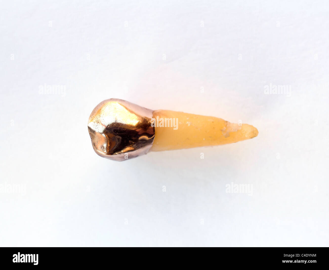 Extrae un diente premolar, que había sido equipado con una corona de oro, posteriormente reparado y luego se extrae Foto de stock