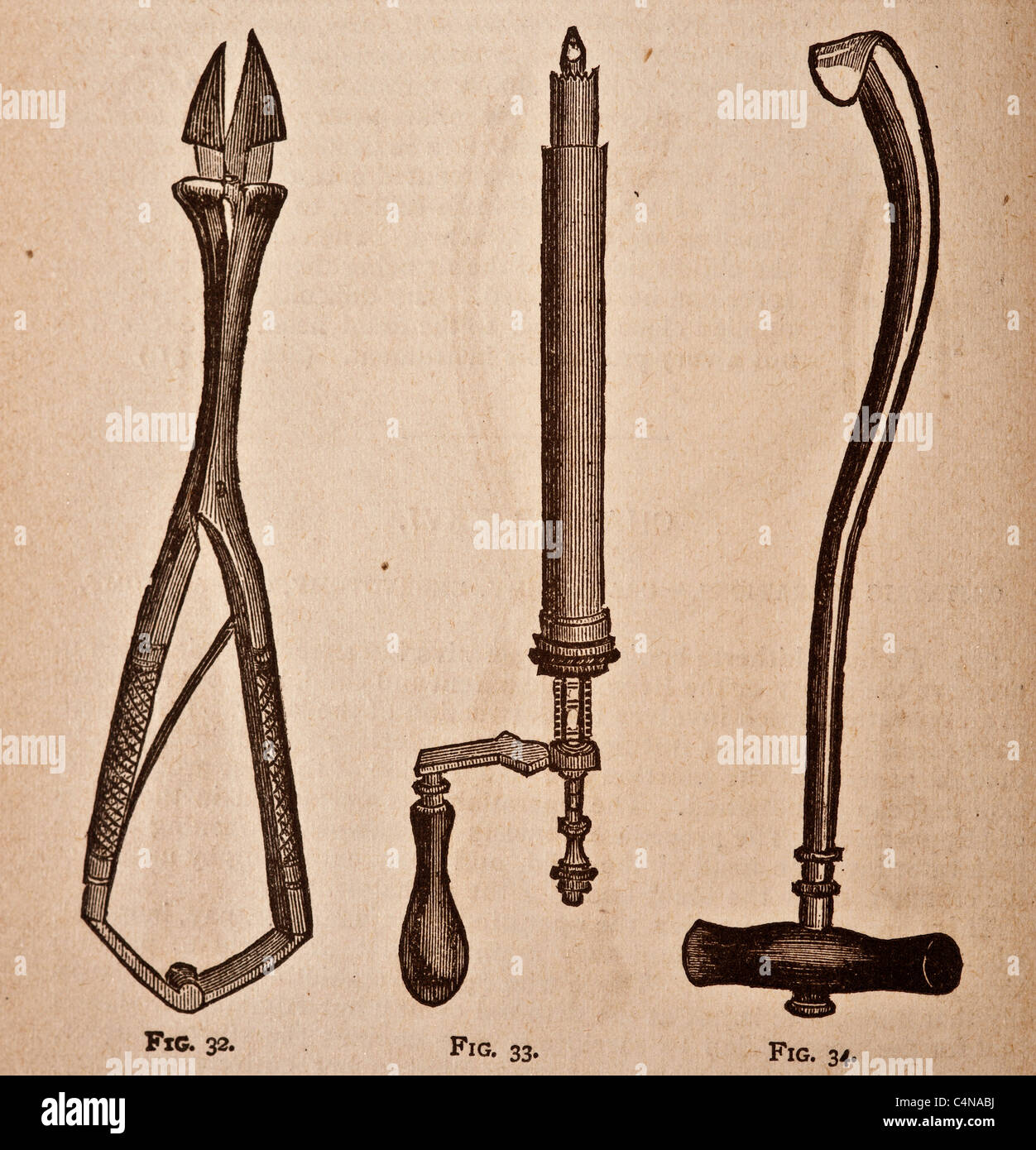Ilustración de antiguos instrumentos quirúrgicos y aparatos médicos  Fotografía de stock - Alamy