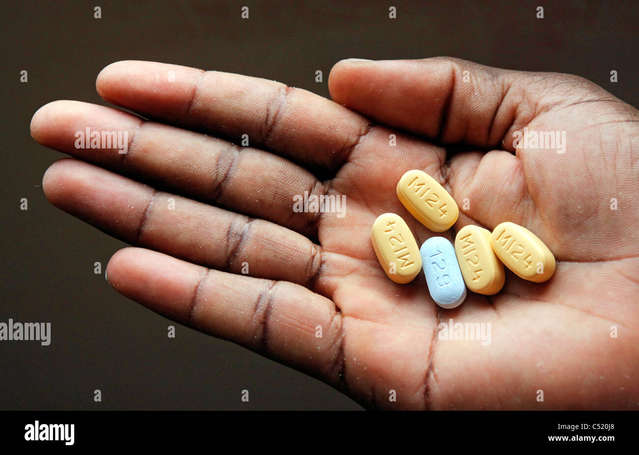 Mano con cinco tabletas de alto medido Antiretoviral ARV medicina. Ración diaria de una persona apenas enfermos de VIH a la lucha contra el SIDA Foto de stock