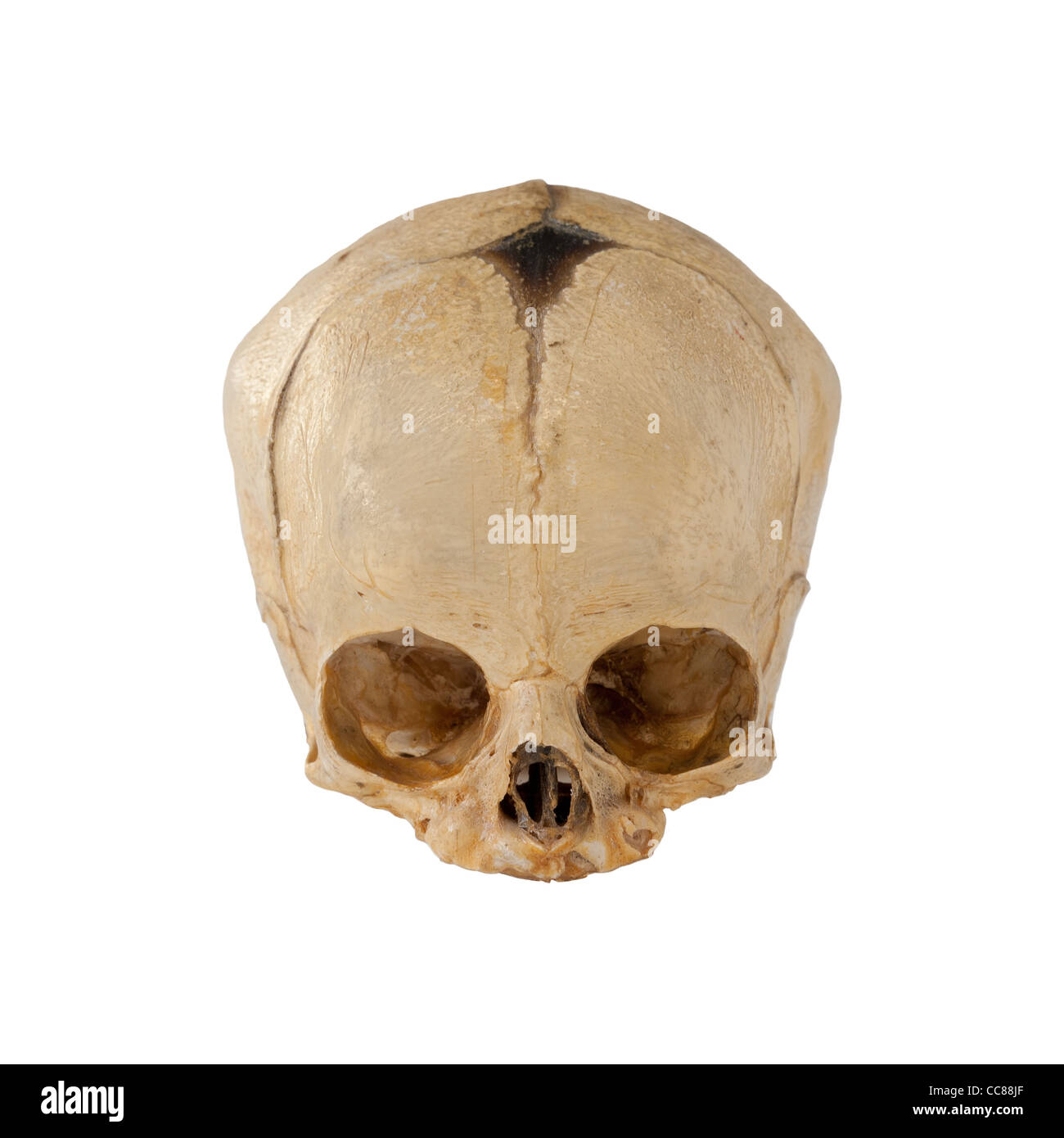 El cráneo de un bebé a término feto skull 9 meses mostrando blanda y  fontanela sutura flexible Fotografía de stock - Alamy