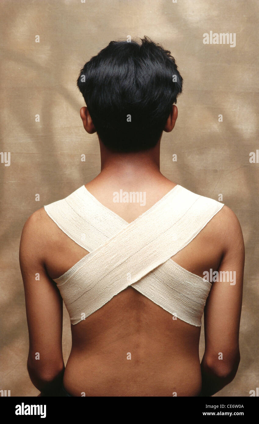 VDA 85128 : El hombre hombro vendaje volver vestirse de fractura esguince  dolor salud india Fotografía de stock - Alamy