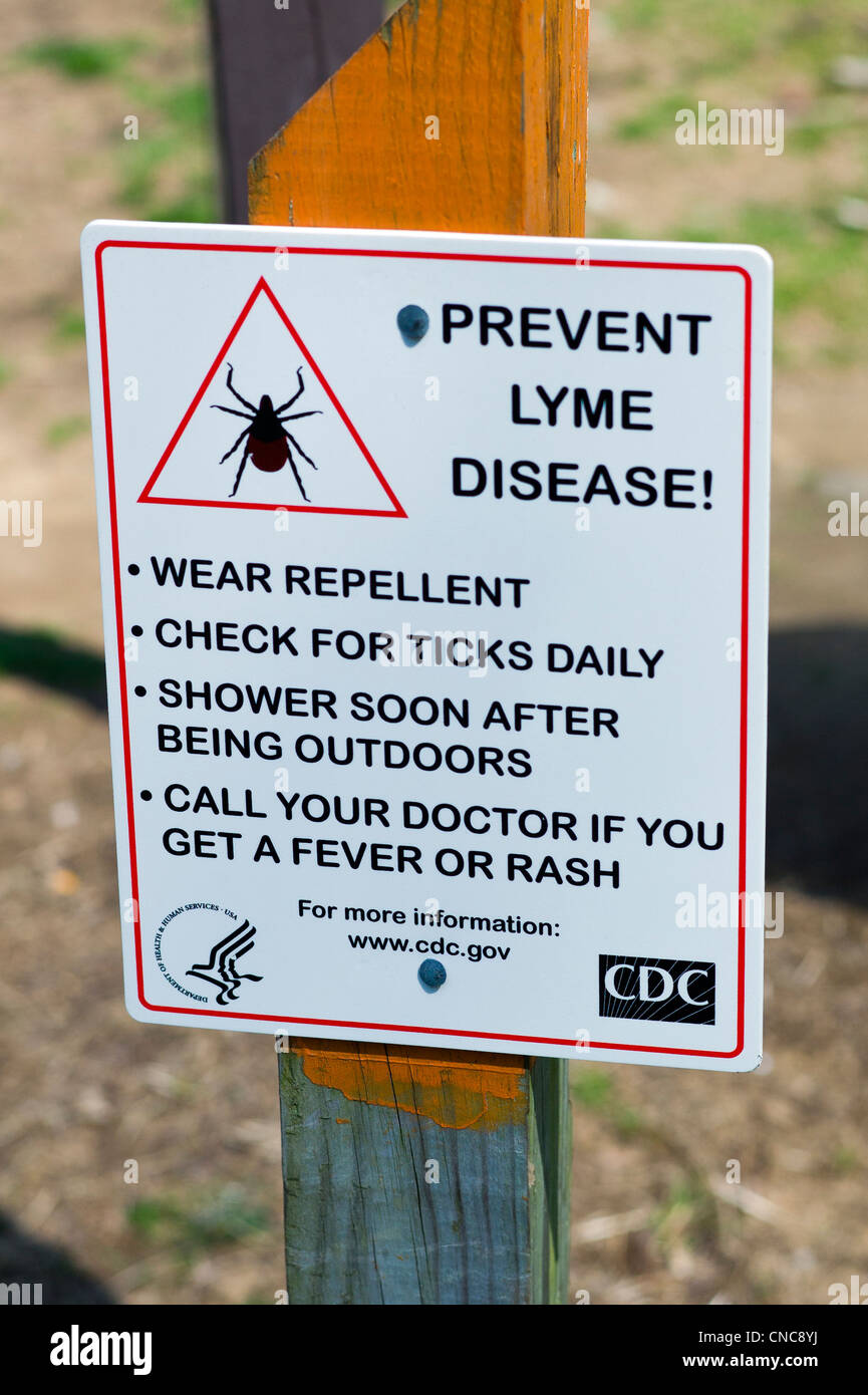 Firmar advirtiendo a los visitantes acerca de la enfermedad de Lyme en Ridley Creek State Park, Pennsylvania, EE.UU. Foto de stock
