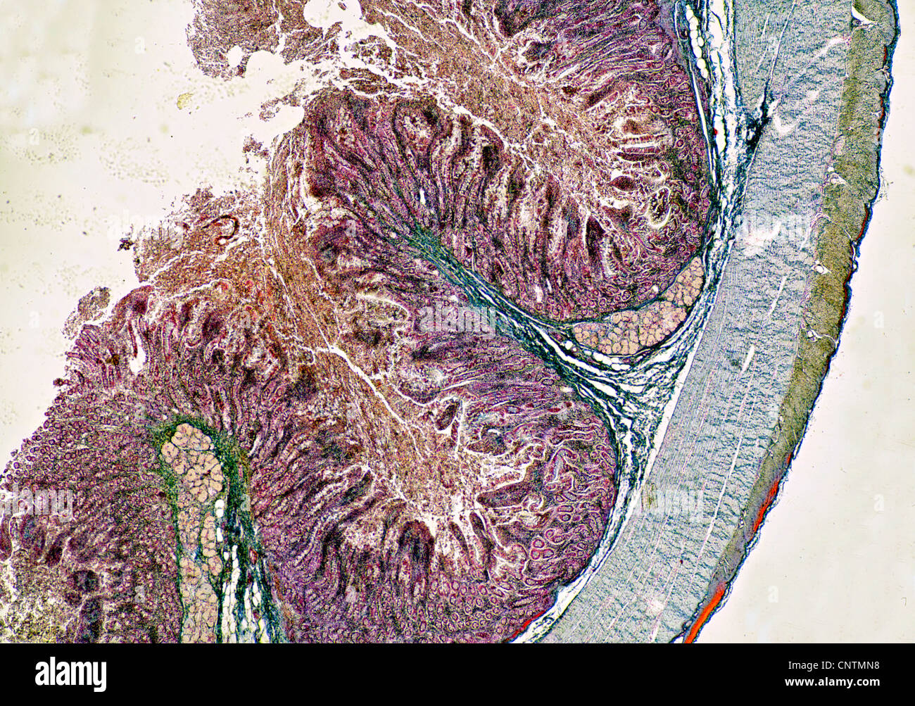 Personas, seres humanos, seres humanos (Homo sapiens sapiens), la sección transversal del intestino delgado Foto de stock