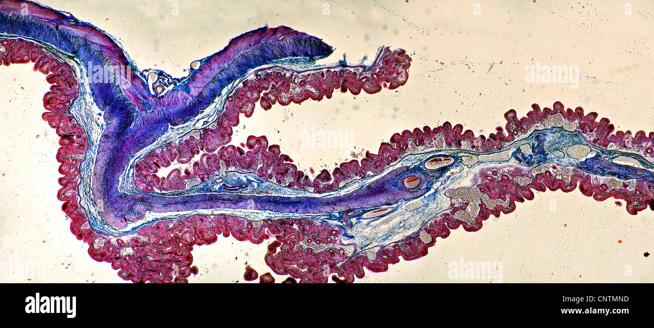 Personas, seres humanos, seres humanos (Homo sapiens sapiens), la sección transversal del intestino grueso Foto de stock