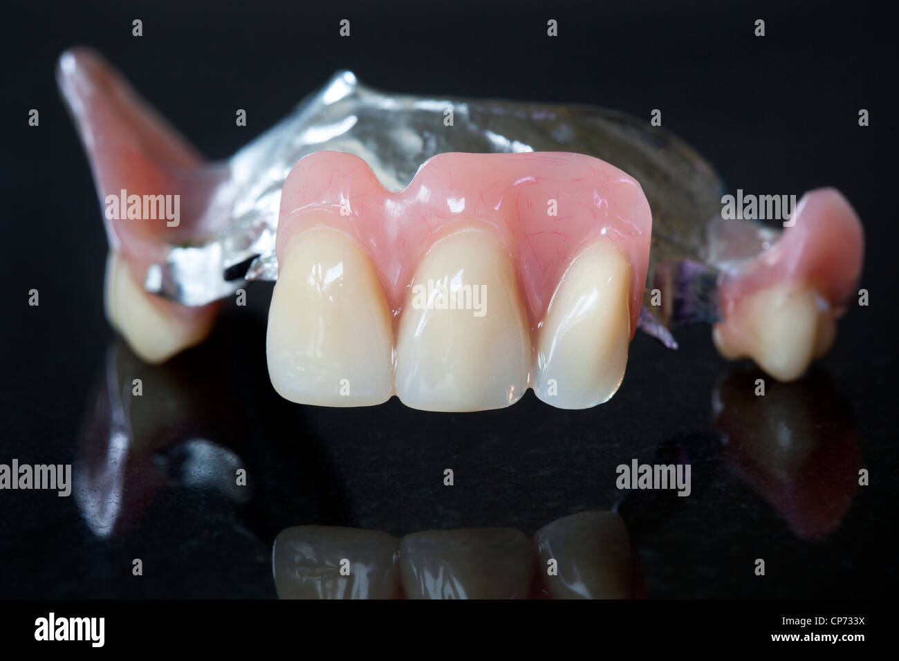 Los dientes postizos o dentaduras postizas Fotografía de stock - Alamy