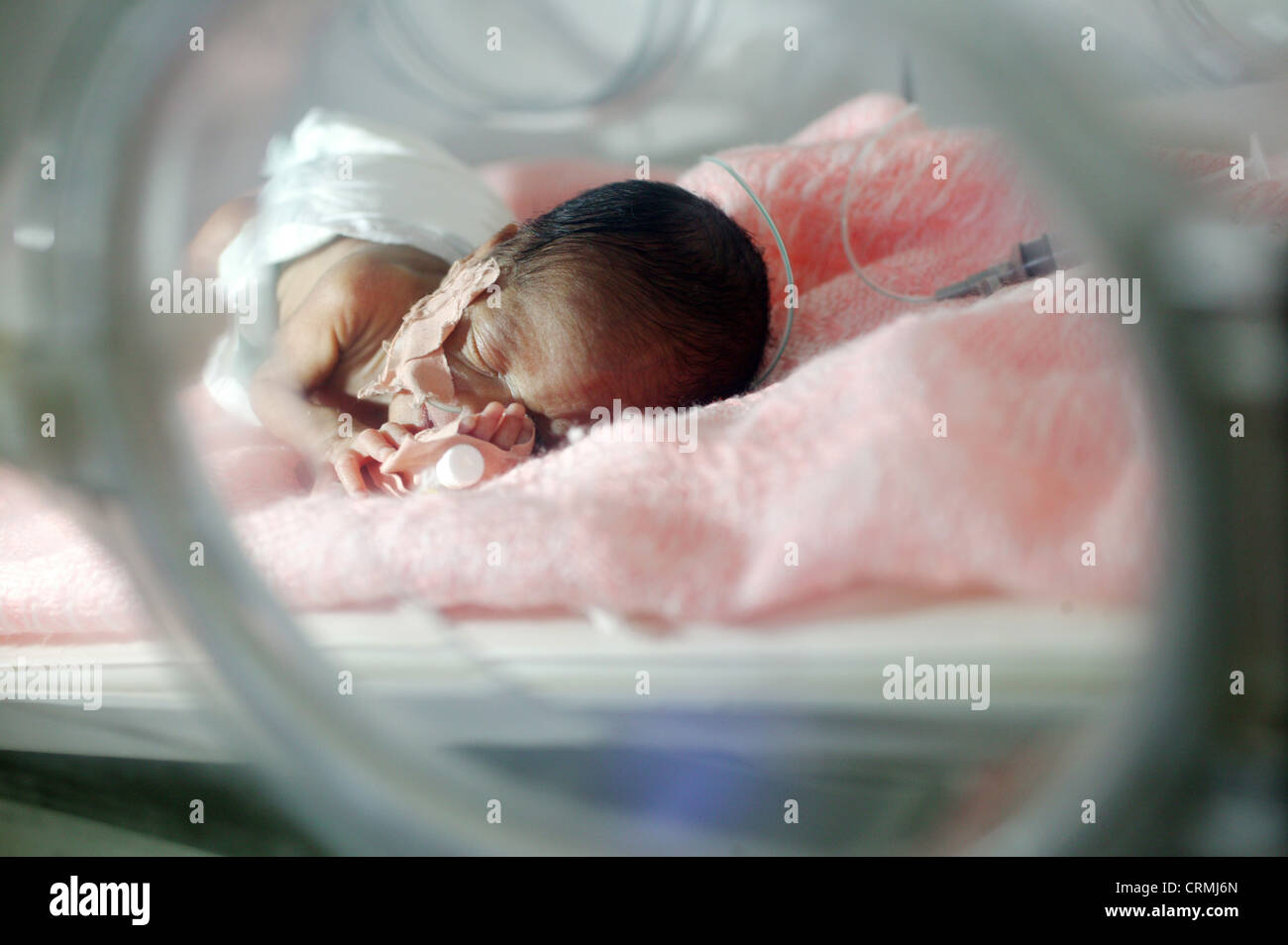 5 días de nacido el bebé prematuro a las 31 semanas pesa 1Kg. El bebé sufre de síndrome de dificultad respiratoria y la ictericia. Foto de stock
