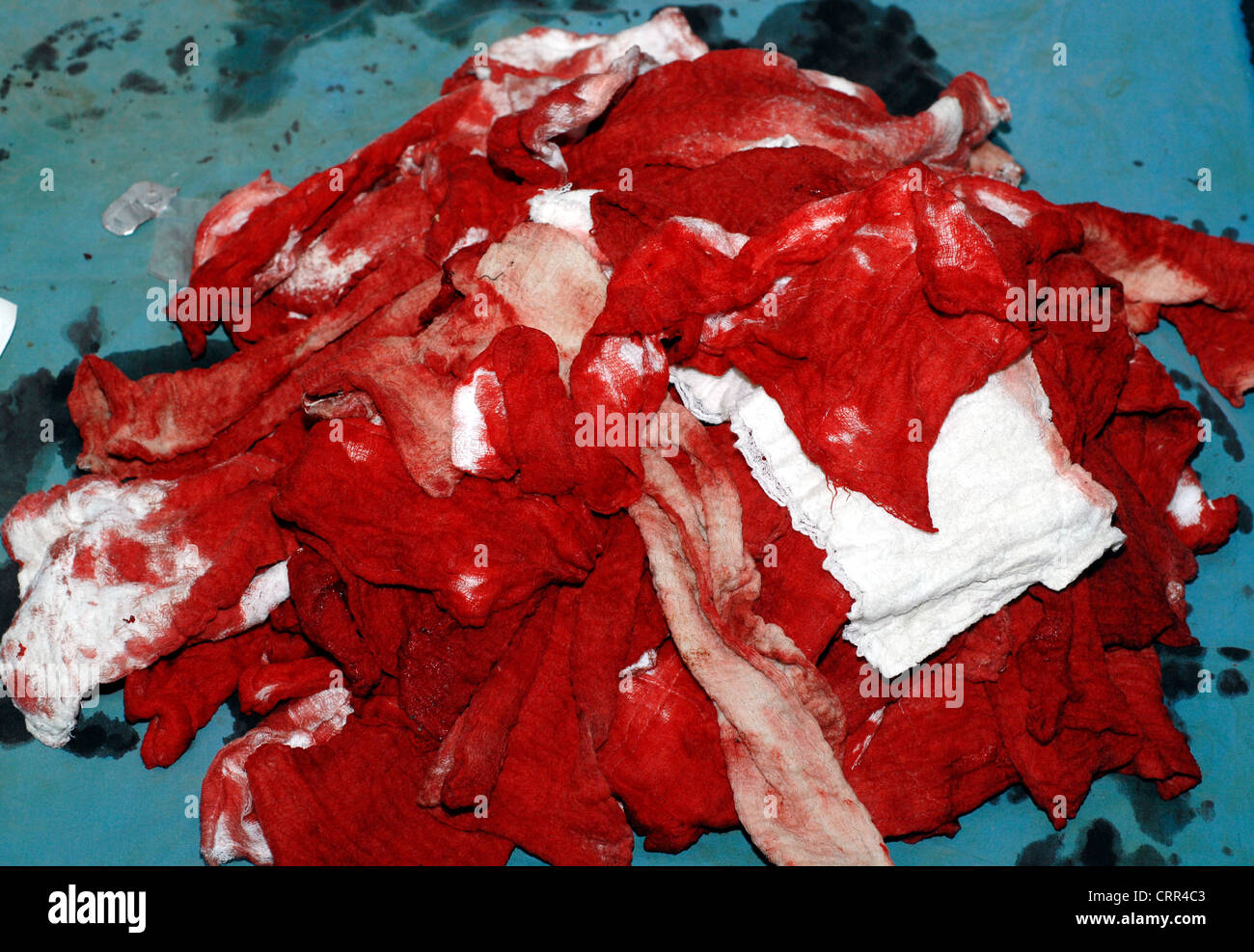 Un gran montón de ensangrentado hisopos quirúrgico acumulado durante el curso de un procedimiento. Foto de stock