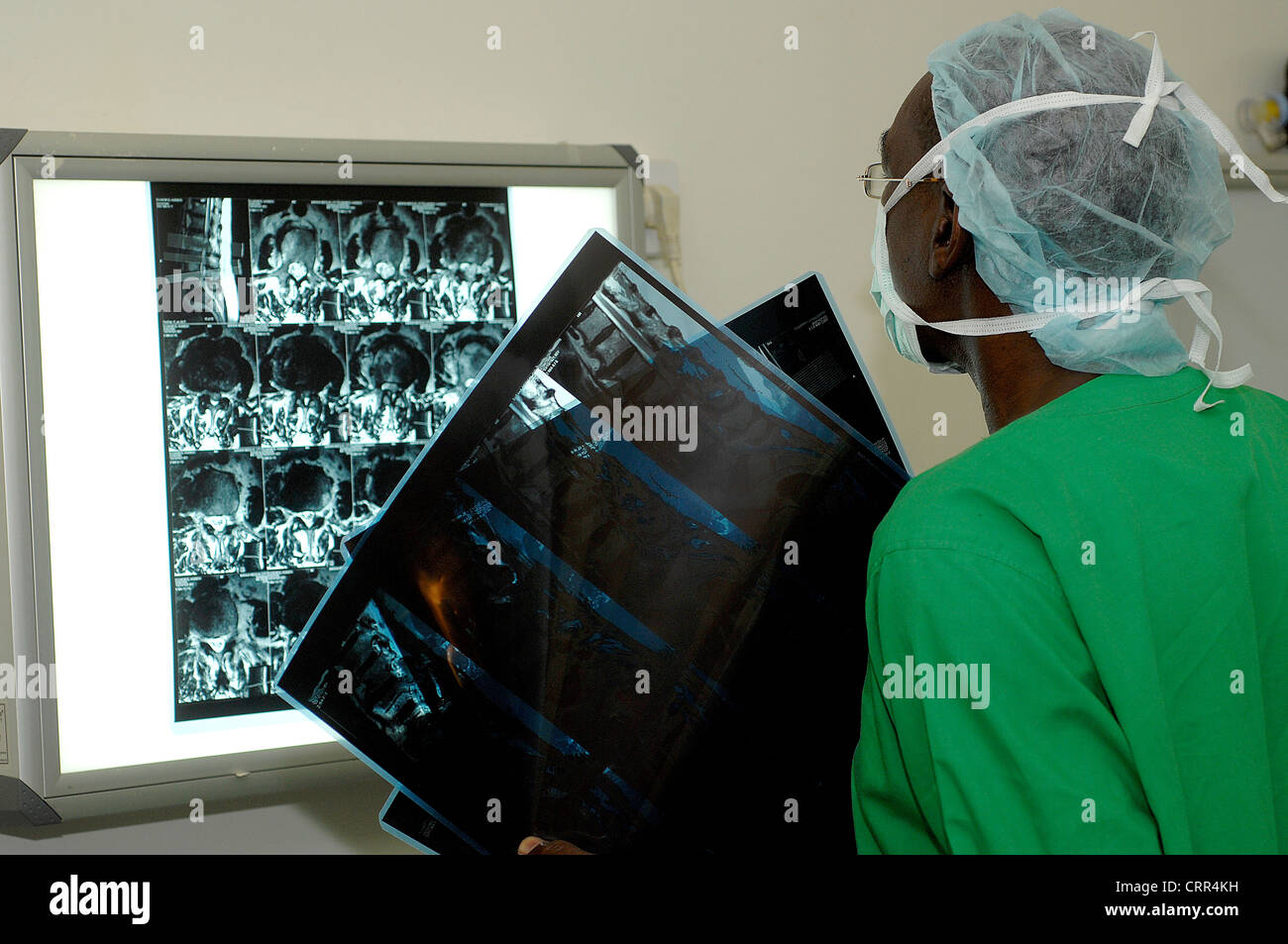 Un cirujano ver radiografías del paciente. Foto de stock