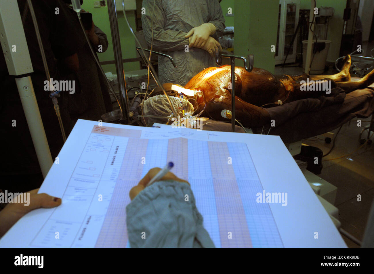 Anestesista llenado gráfico con anestésico preparado Paciente en segundo plano. Foto de stock
