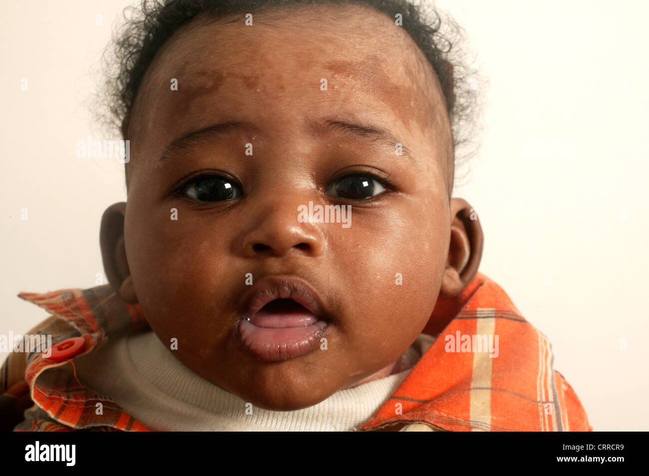 Cerca de la cara de un niño pequeño. Que el niño haya realizado una punción lumbar. Foto de stock