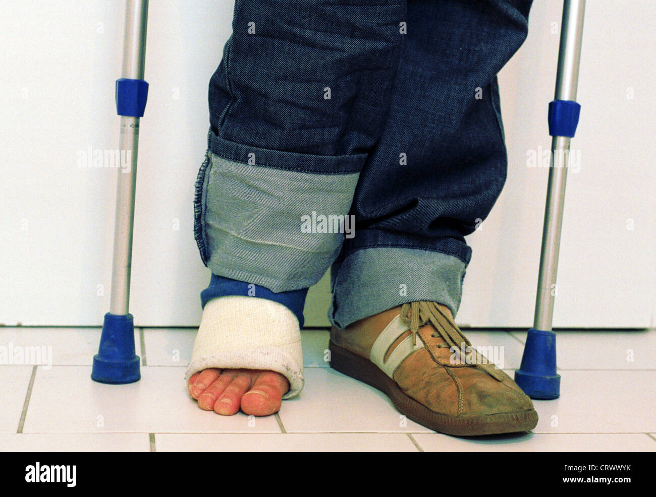 Pie enyesado fotografías e imágenes de alta resolución Alamy