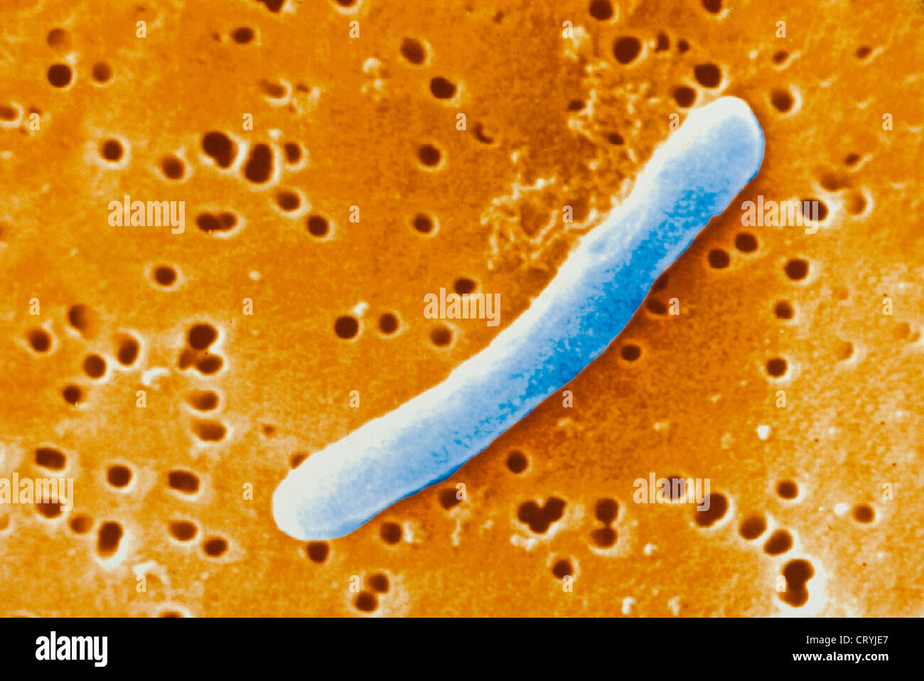Bacteria clostridium tetani fotograf??as e im??genes de alta resoluci??n