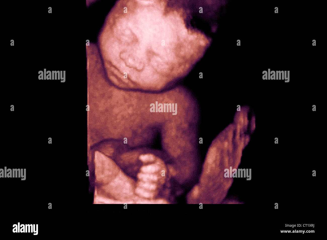 Feto 6 Semanas Fotos E Imagenes De Stock Alamy