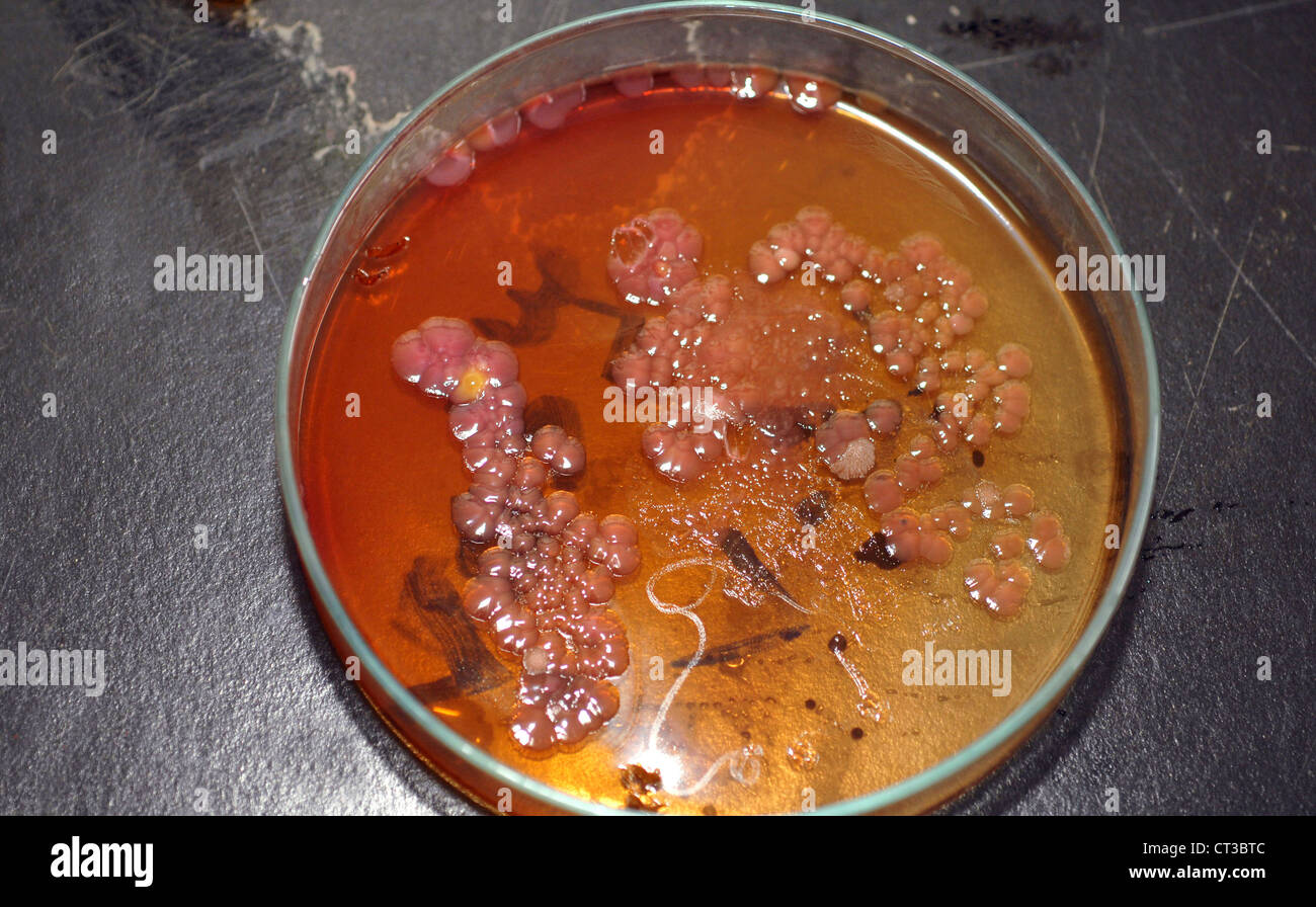 El cultivo bacteriano que crece en una placa petri de agar gelatina. Foto de stock