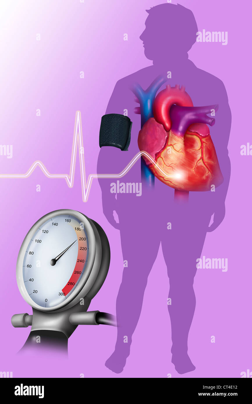 La presión arterial alta, dibujo Fotografía de stock - Alamy