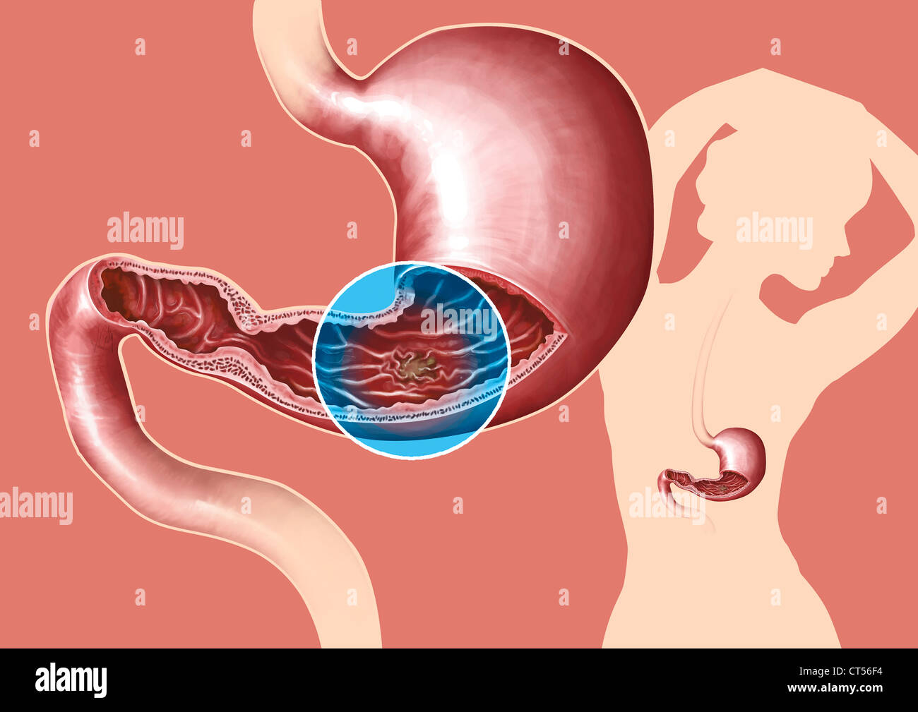 Mucosa Gastrica Fotos E Im Genes De Stock Alamy