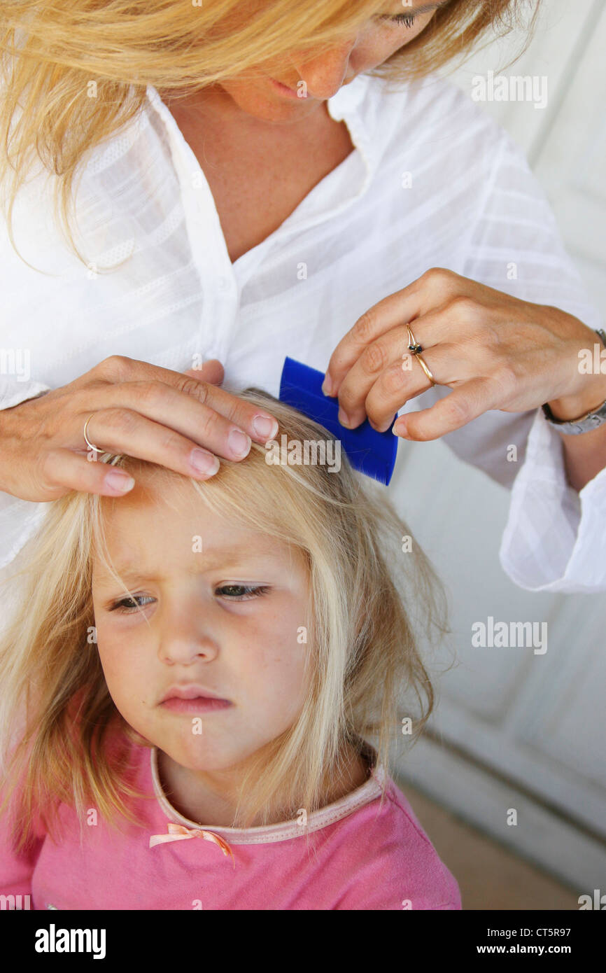 Tratamiento contra los piojos en un niño Fotografía de stock - Alamy