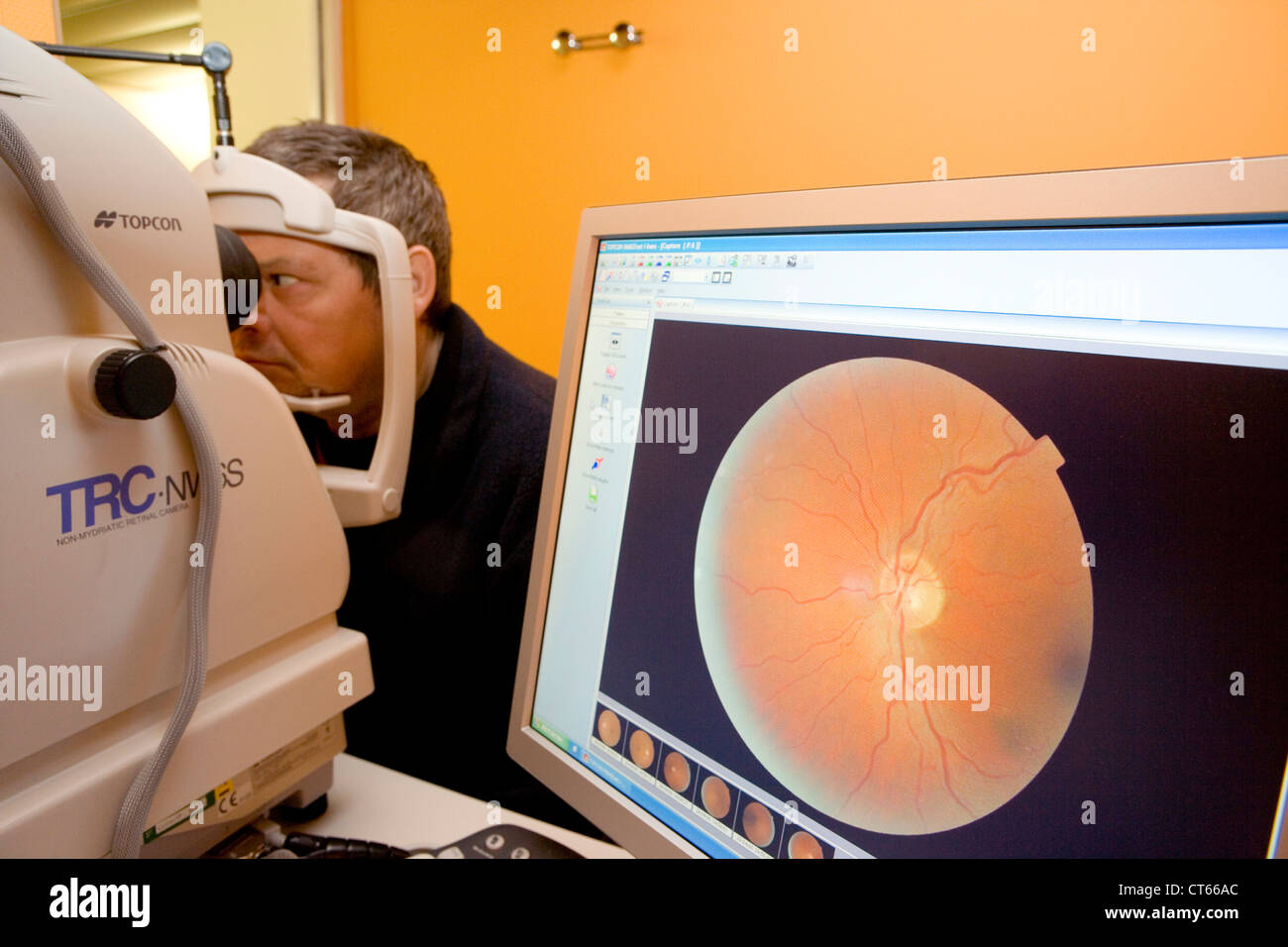 Examen de fondo de ojo Fotografía de stock - Alamy
