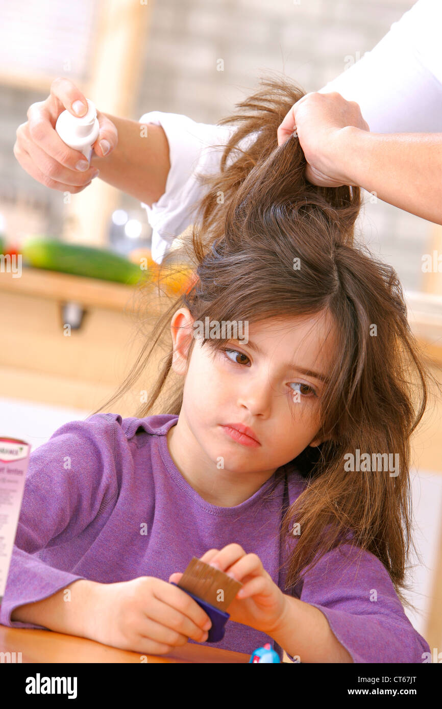 Tratamiento contra los piojos en un niño Fotografía de stock - Alamy