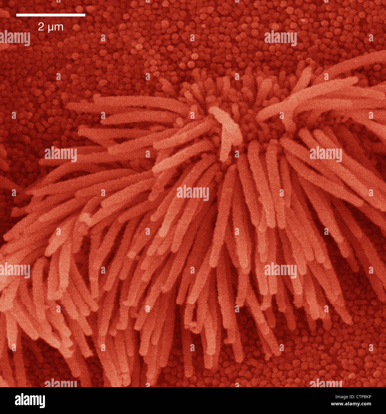 Imagen por microscopio electrónico de barrido de la tráquea de epitelio pulmonar Foto de stock