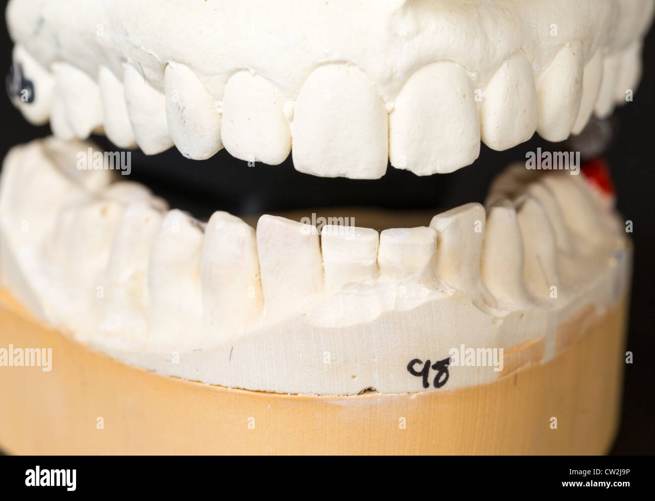 Dentaduras postizas dientes dentales dientes falsos fotografías e imágenes  de alta resolución - Alamy