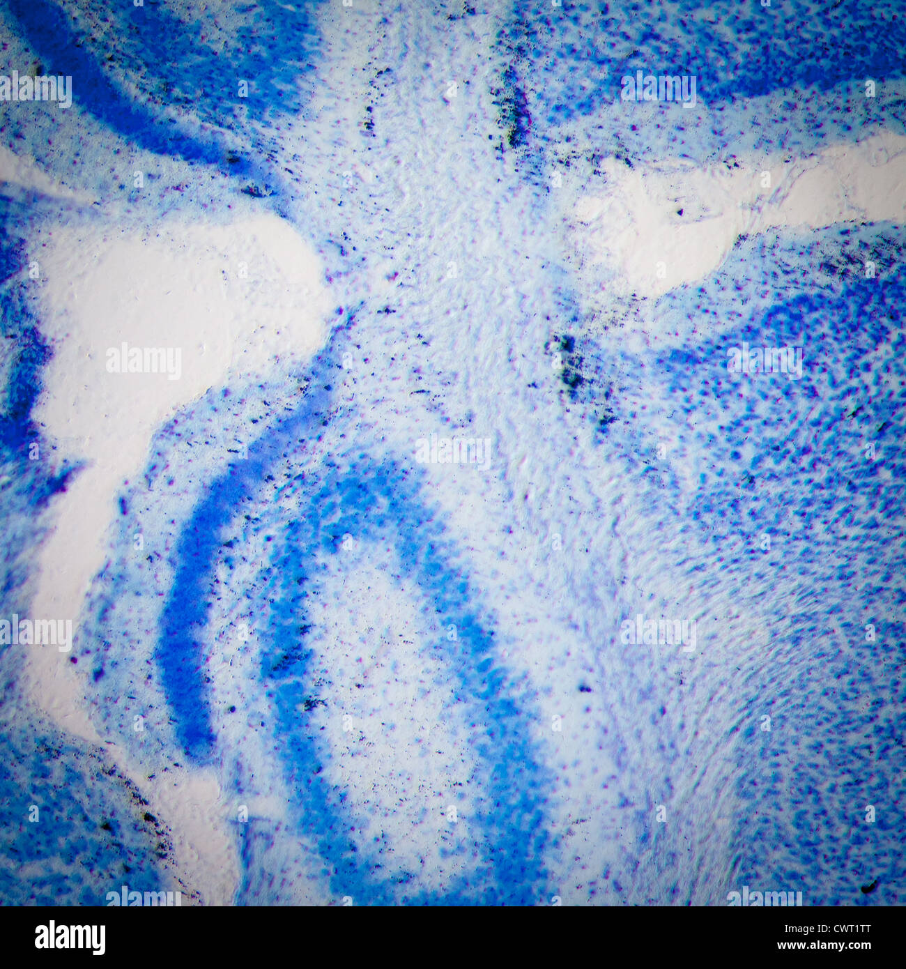 La ciencia médica micrografía de microscopía, las neuronas del hipocampo de cerebro de rata Foto de stock