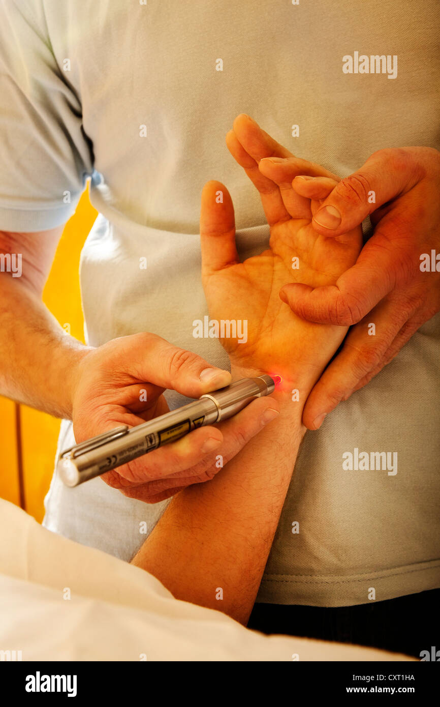 La mano está siendo tratada con un láser. Foto de stock