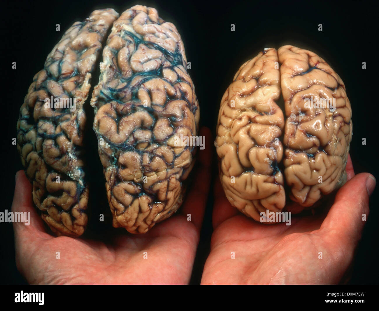 Размер мозга увеличивается. Размер мозга человека. Мозг усного и глубого человека.
