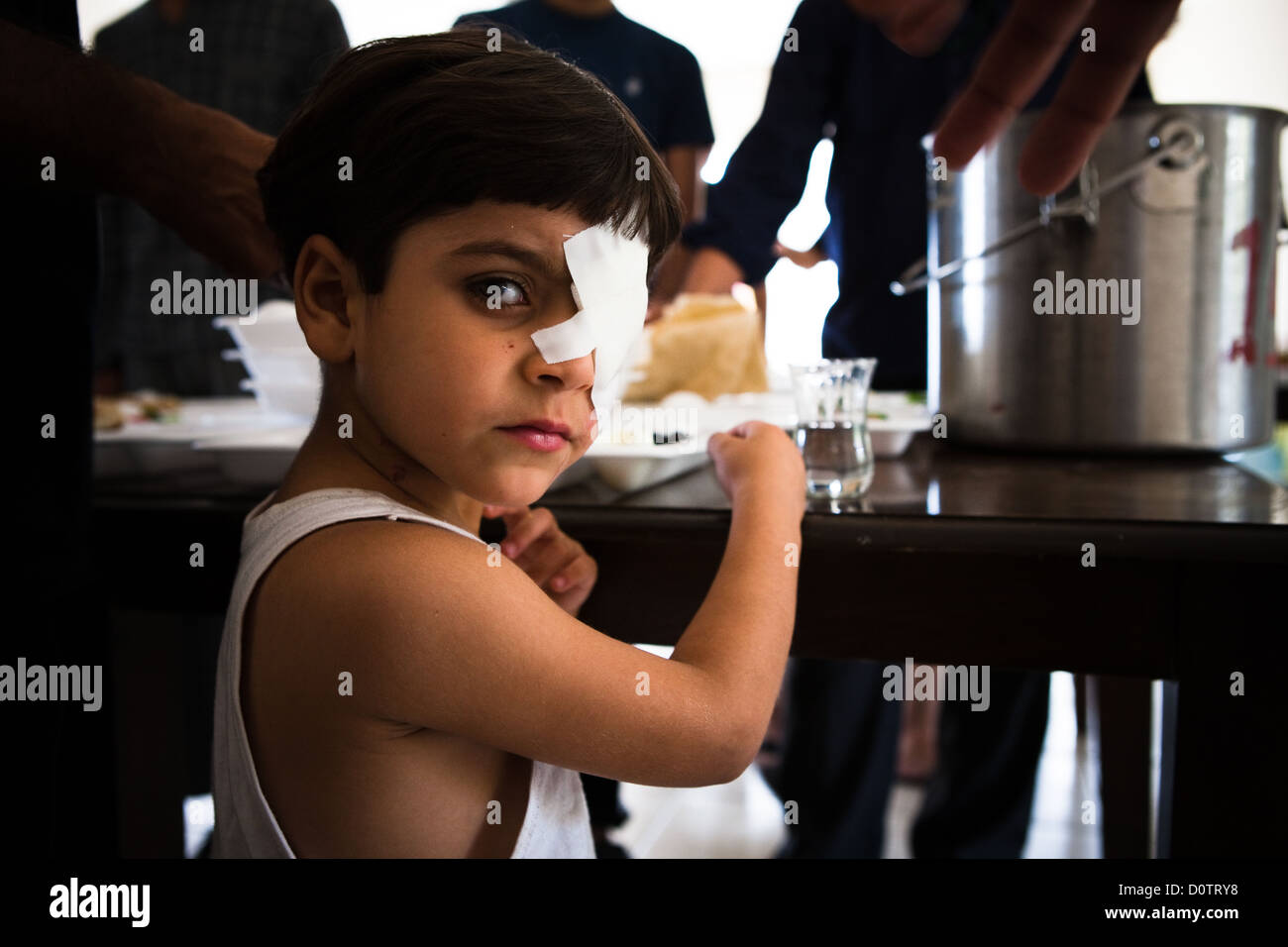 29/09/12, Reyhanli, Turquía. Huérfano de Siria con una lesión ocular en un hospital de recuperación en Turquía. Foto de stock