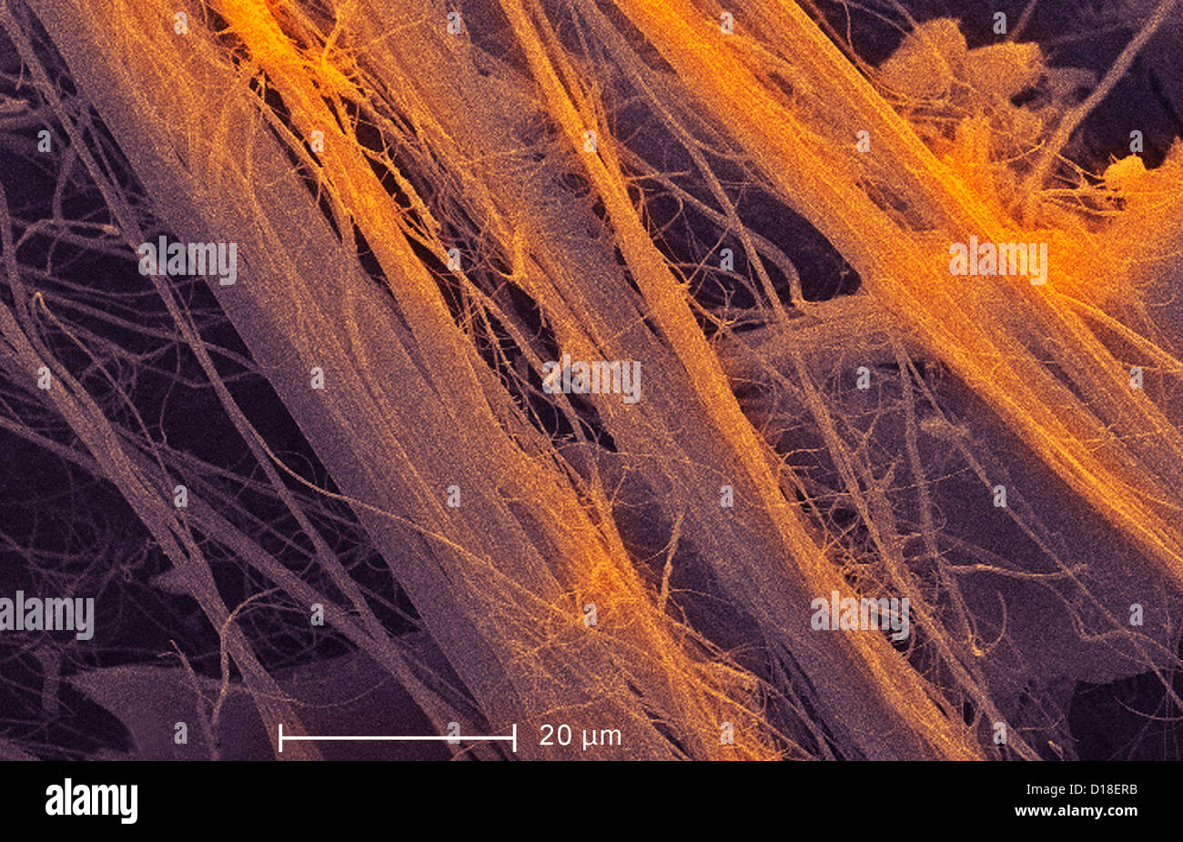 Micrografía electrónica de amianto, 1200x Foto de stock