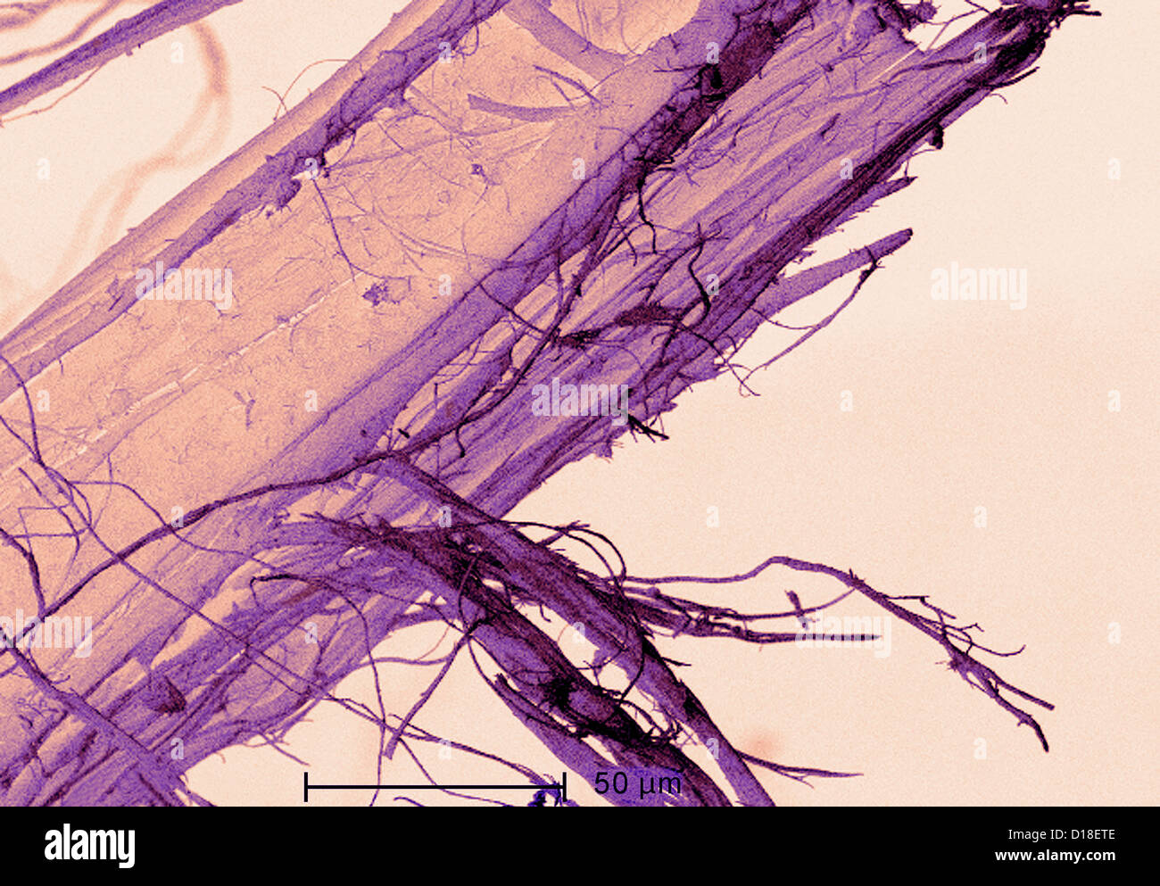 Micrografía electrónica de amianto Foto de stock