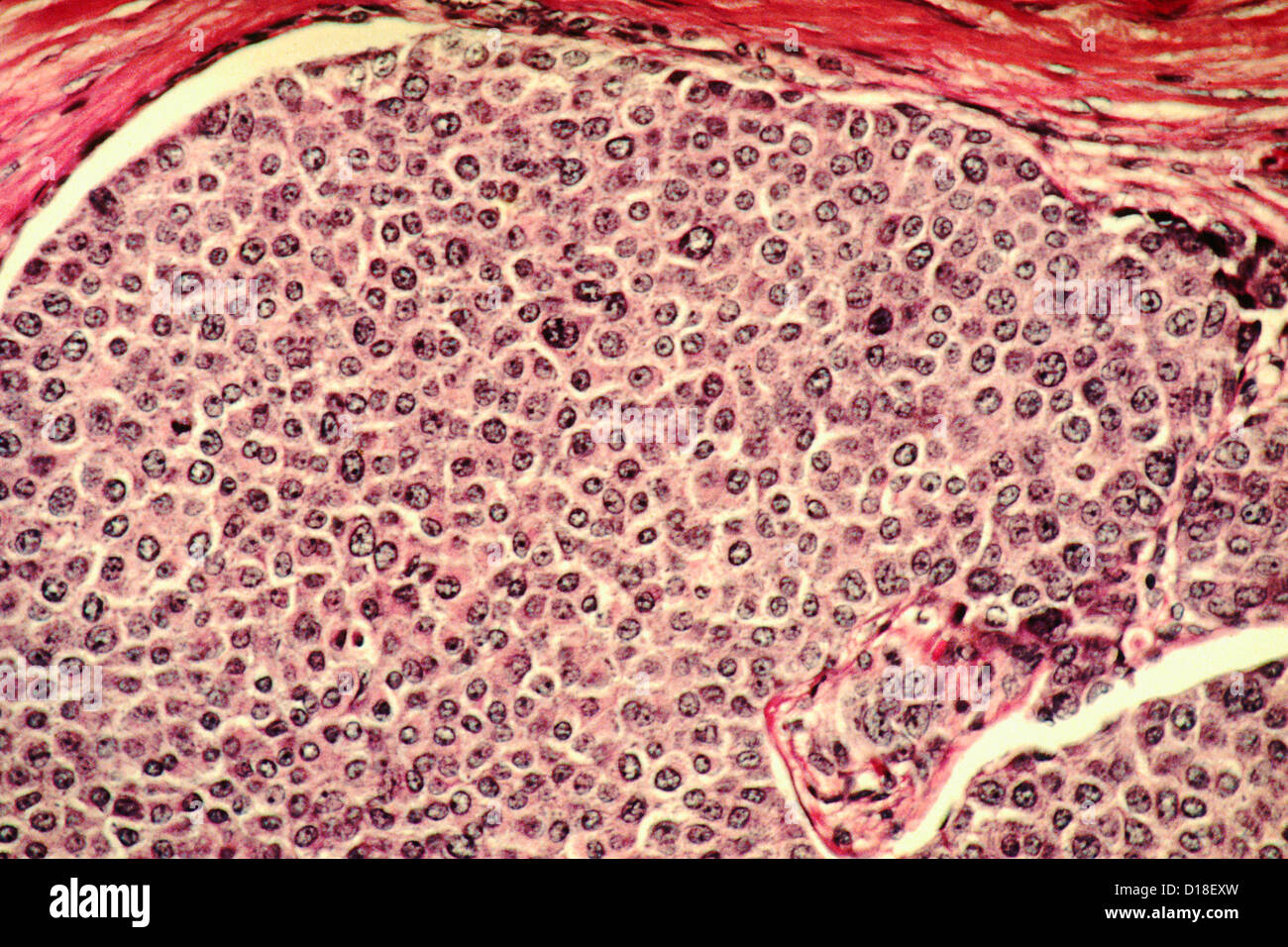Microscopio de luz histología de células de cáncer de mama Fotografía de  stock - Alamy